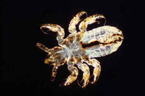 جرب العانة Pubic Scabies