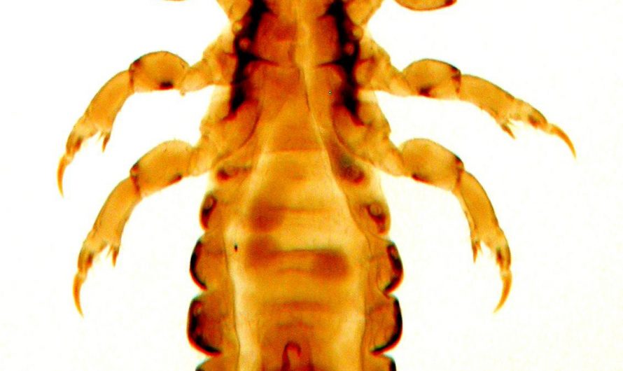 قمل العانة Pubic Lice